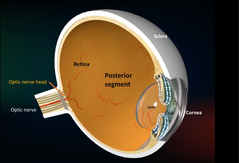 Visão tridimensional do globo ocular em corte mostrando segmento posterior, retina, cristalino, íris, córnea, esclera e nervo óptico